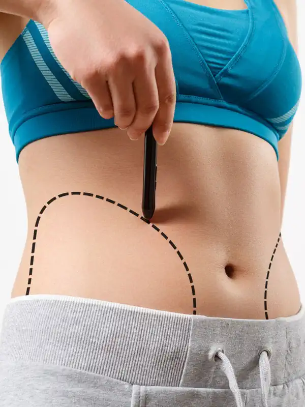 Liposuction (Full Body) Liposuction (Full Body)